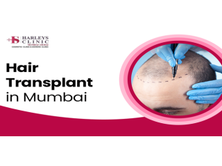 advanced-hair-transplant-in-mumbai-by-expert-surgeons-small-0