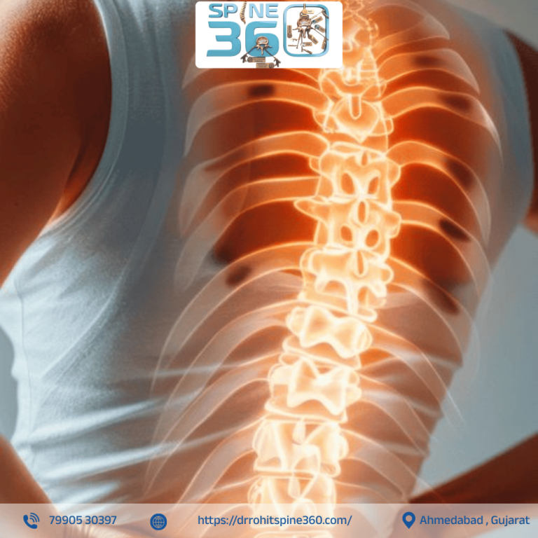 lumbar-spondylosis-treatment-in-ahmedabad-by-dr-rohit-thaker-big-0