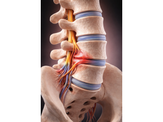 expert-neurosurgery-care-in-india-sushrut-brain-spine-small-1