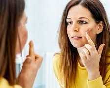 best-skin-specialist-in-delhi-visit-citrine-clinic