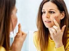 best-skin-specialist-in-delhi-visit-citrine-clinic
