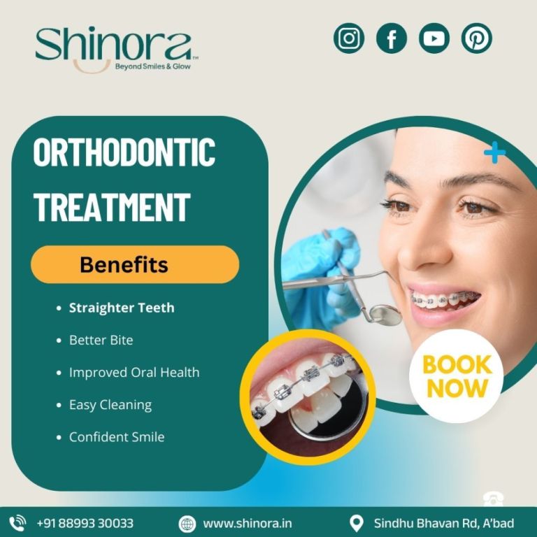 orthodontic-treatment-in-ahmedabad-shinora-clinic-big-0