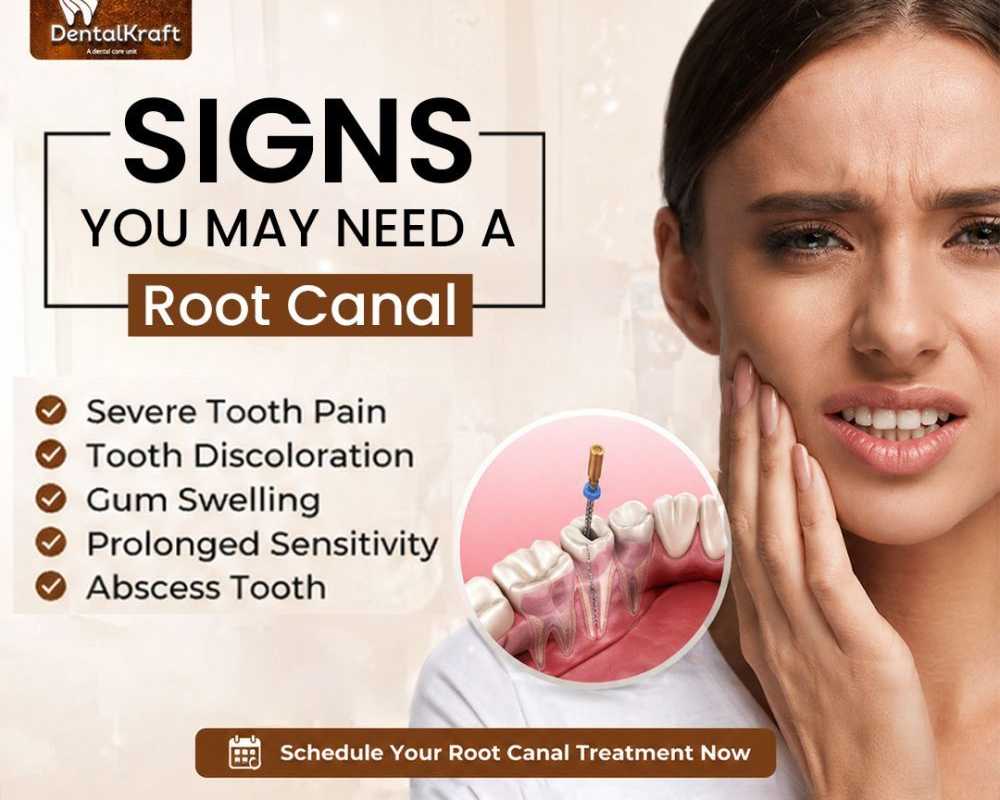 root-canal-treatment-in-indirapuram-for-pain-relief