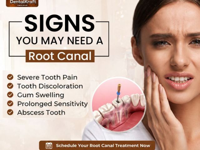 root-canal-treatment-in-indirapuram-for-pain-relief
