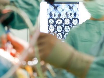 how-saroj-hospital-provides-expert-care-for-epilepsy-patients