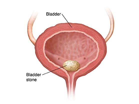 best-hospital-for-bladder-control-problems