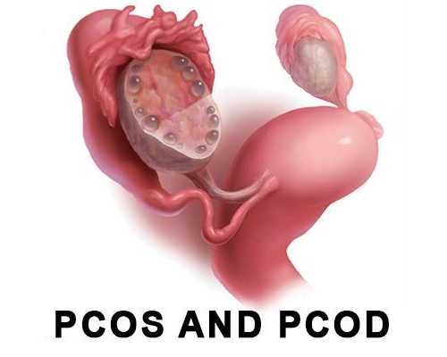 best-hospital-for-pcod-and-pcos-treatment