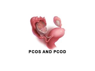best-hospital-for-pcod-and-pcos-treatment-small-0