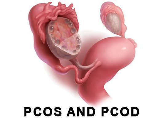 best-hospital-for-pcod-and-pcos-treatment