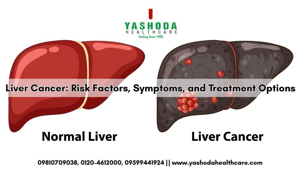 best-hospital-for-liver-cancer-big-0