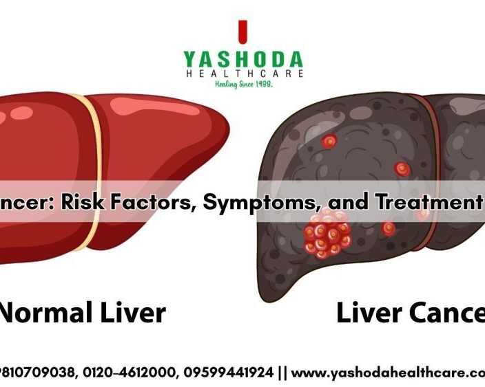 best-hospital-for-liver-cancer
