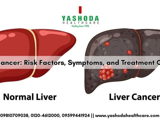 best-hospital-for-liver-cancer