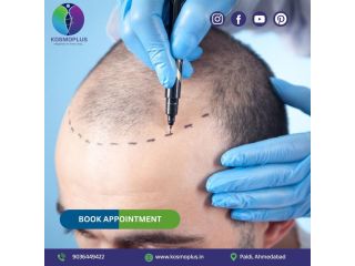 get-safe-and-trusted-care-with-hair-transplant-in-ahmedabad-small-0
