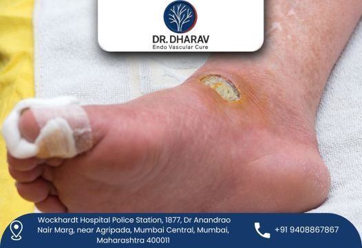 protect-your-feet-with-advanced-diabetic-foot-treatment-big-0