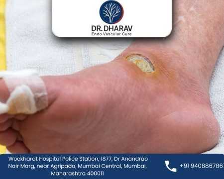 protect-your-feet-with-advanced-diabetic-foot-treatment