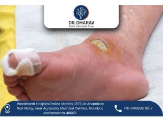 protect-your-feet-with-advanced-diabetic-foot-treatment-small-0