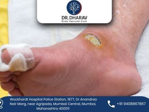 protect-your-feet-with-advanced-diabetic-foot-treatment