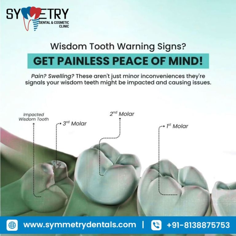 wisdom-teeth-removal-near-me-for-safe-surgical-treatment-big-0