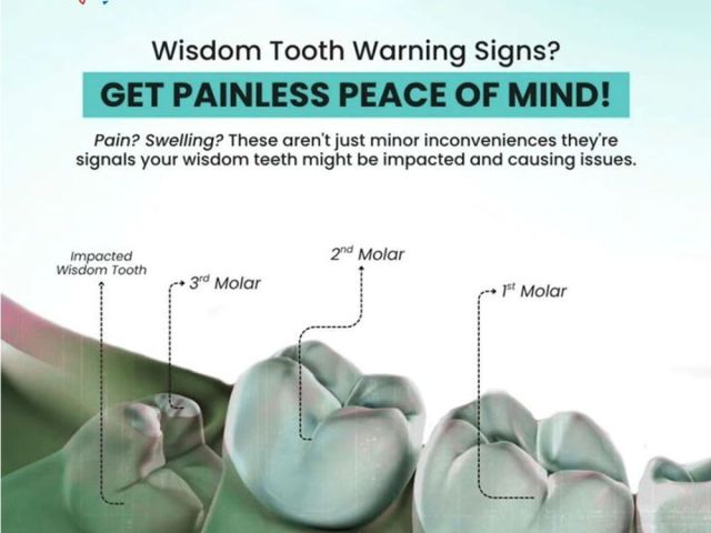 wisdom-teeth-removal-near-me-for-safe-surgical-treatment