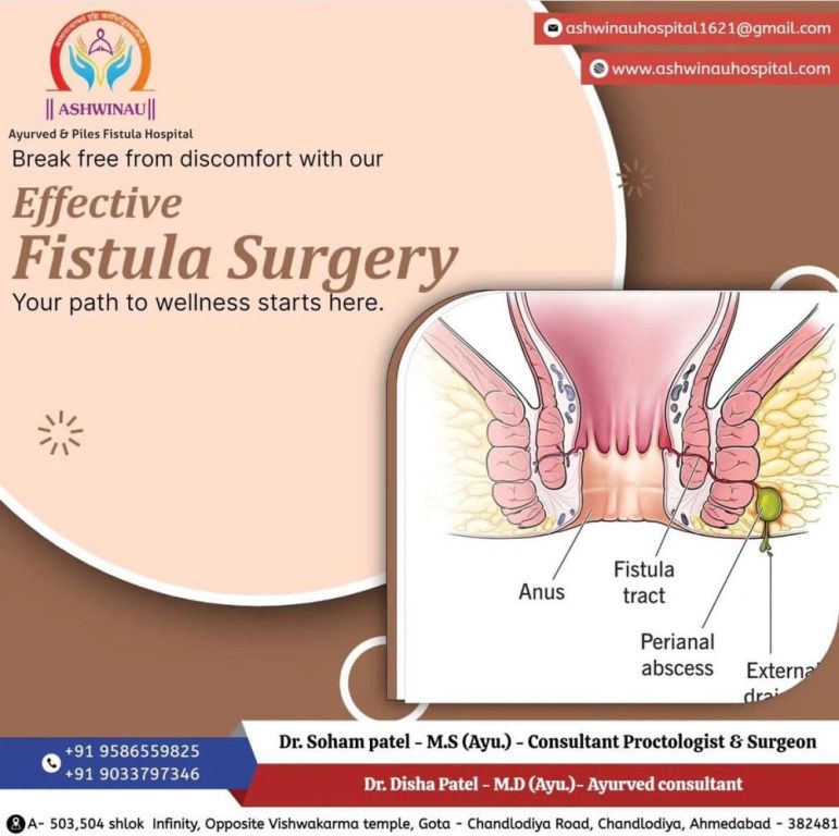 fistula-treatment-in-ahmedabad-at-ashwinau-hospital-big-0