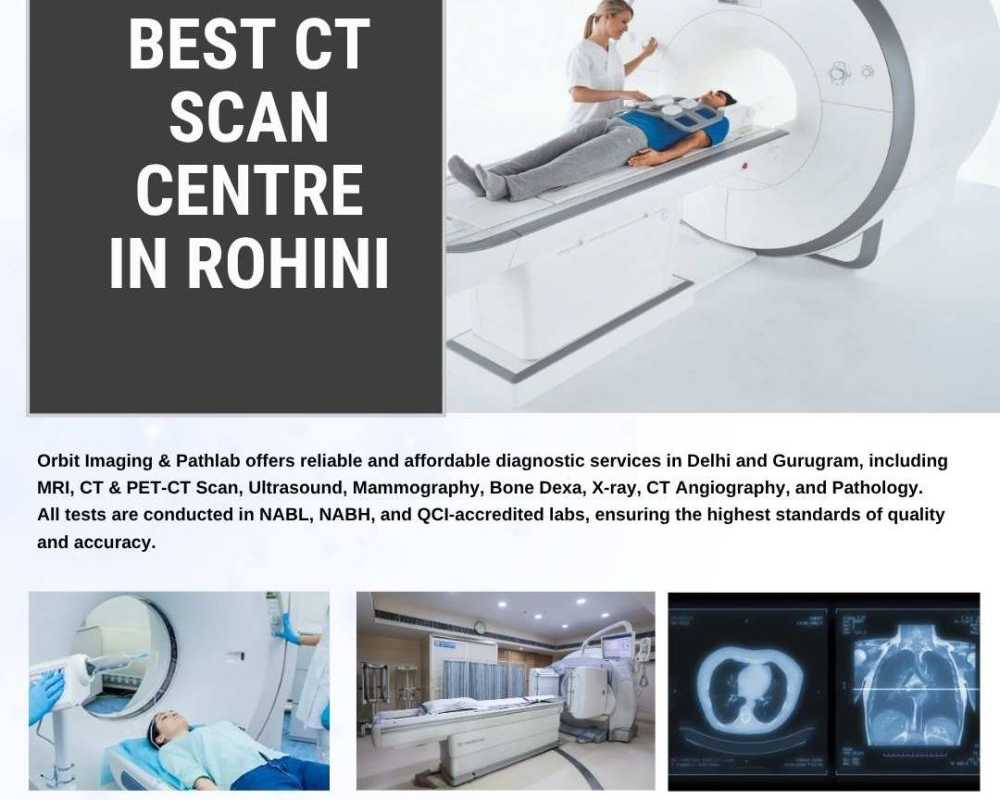 best-ct-scan-centre-in-rohini-orbit-imaging