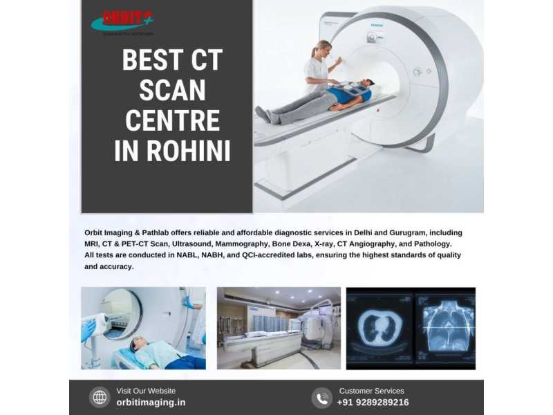 best-ct-scan-centre-in-rohini-orbit-imaging-small-0