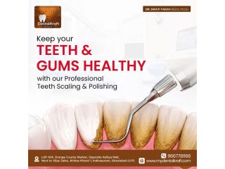 teeth-whitening-treatment-in-indirapuram-small-0