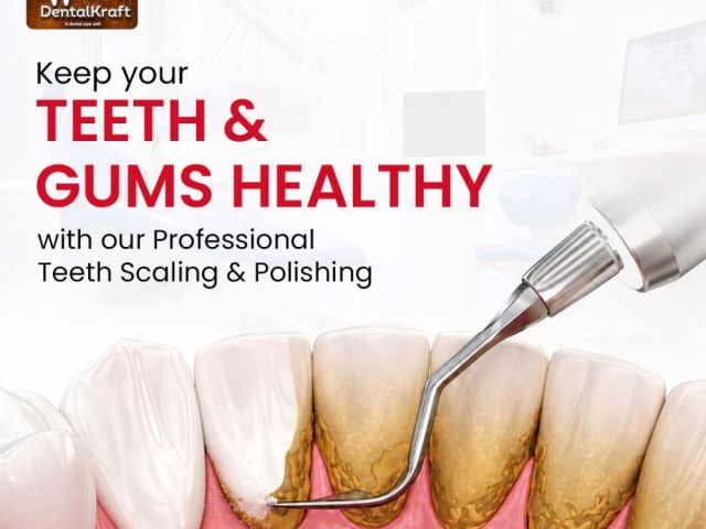 teeth-whitening-treatment-in-indirapuram