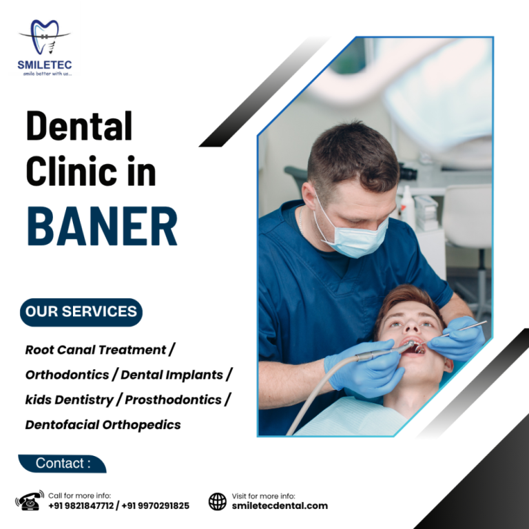 smiletec-dental-clinic-in-baner-your-smile-our-priority-big-0