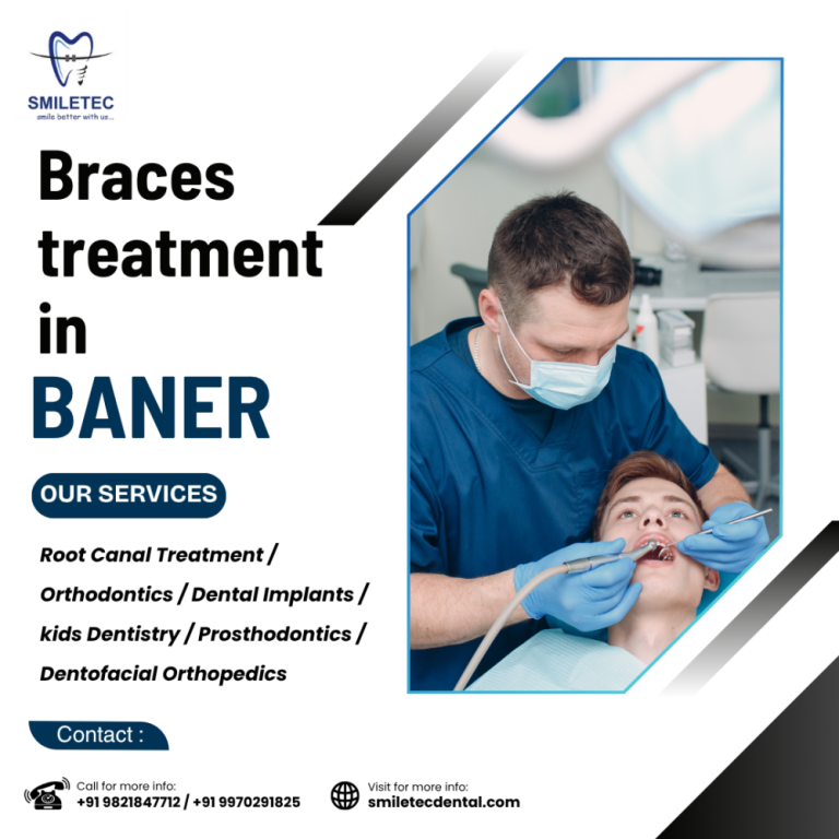 trusted-dental-clinic-in-baner-for-family-dental-care-big-0