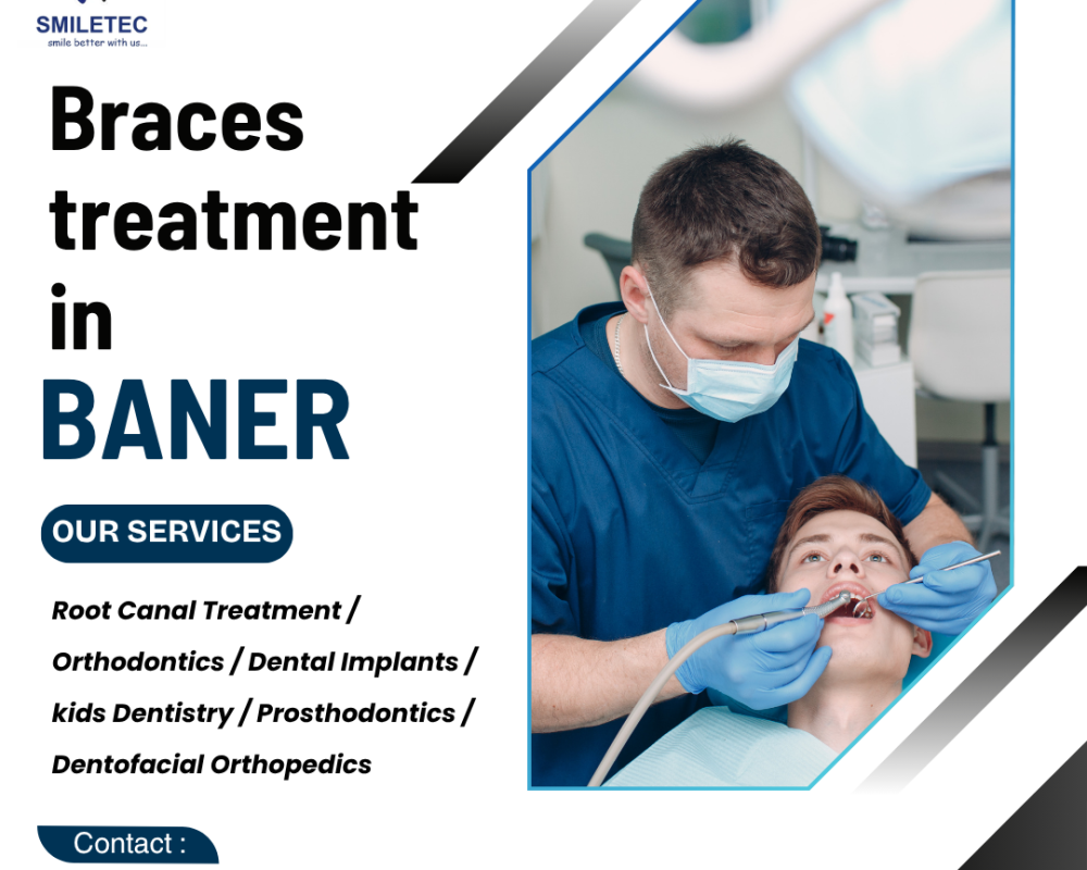 trusted-dental-clinic-in-baner-for-family-dental-care