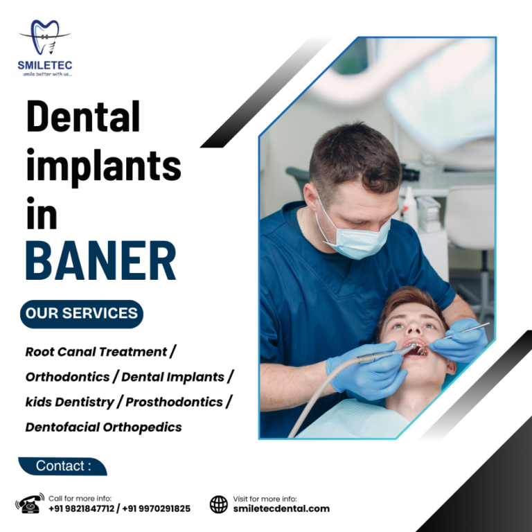 leading-dental-clinic-in-baner-for-cosmetic-general-dentistry-big-0