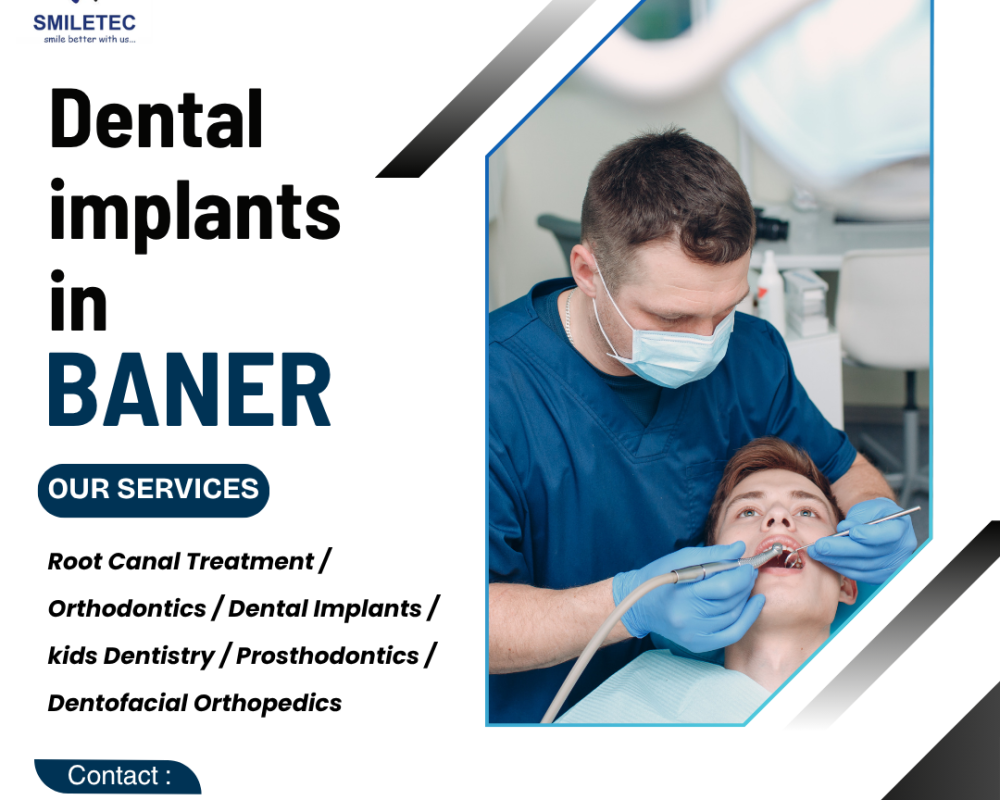 leading-dental-clinic-in-baner-for-cosmetic-general-dentistry