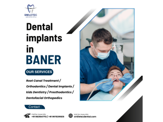 leading-dental-clinic-in-baner-for-cosmetic-general-dentistry-small-0