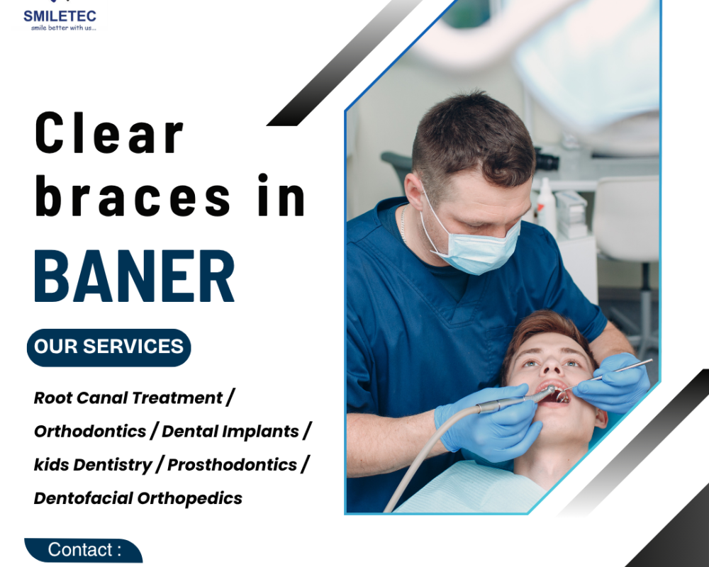 professional-dental-clinic-in-baner-for-all-treatments
