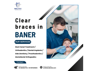 professional-dental-clinic-in-baner-for-all-treatments-small-0