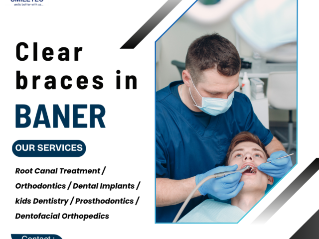 professional-dental-clinic-in-baner-for-all-treatments