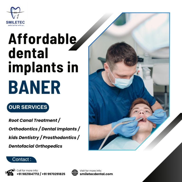affordable-dental-clinic-in-baner-with-expert-dentists-big-0