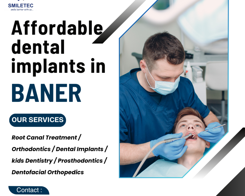affordable-dental-clinic-in-baner-with-expert-dentists