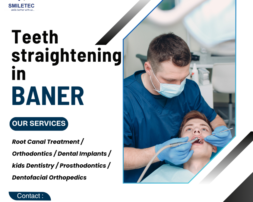 top-dental-clinic-in-baner-for-healthy-beautiful-smiles