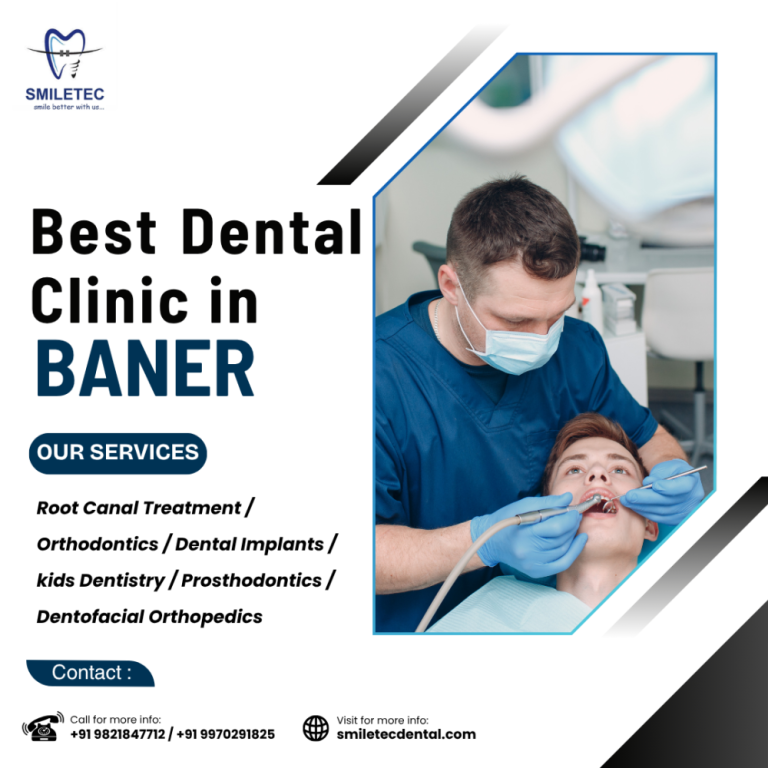 smiletec-dental-clinic-advanced-dental-care-in-baner-big-0