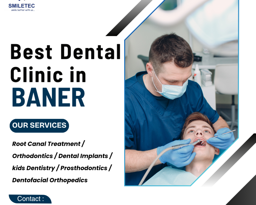 smiletec-dental-clinic-advanced-dental-care-in-baner