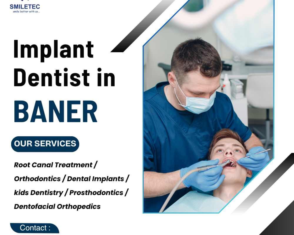 best-dental-clinic-in-baner-for-complete-oral-care