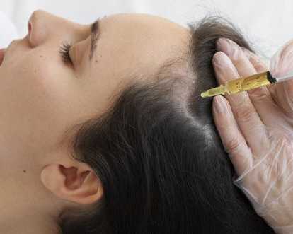 gfc-treatment-for-hair-loss-aesthetic-dermatology-clinic