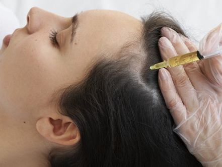 gfc-treatment-for-hair-loss-aesthetic-dermatology-clinic