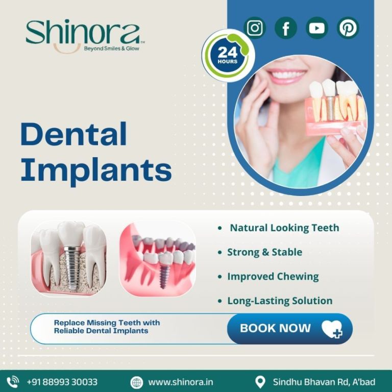 get-strong-teeth-with-dental-implants-in-ahmedabad-big-0