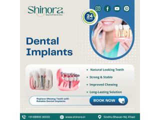 get-strong-teeth-with-dental-implants-in-ahmedabad-small-0
