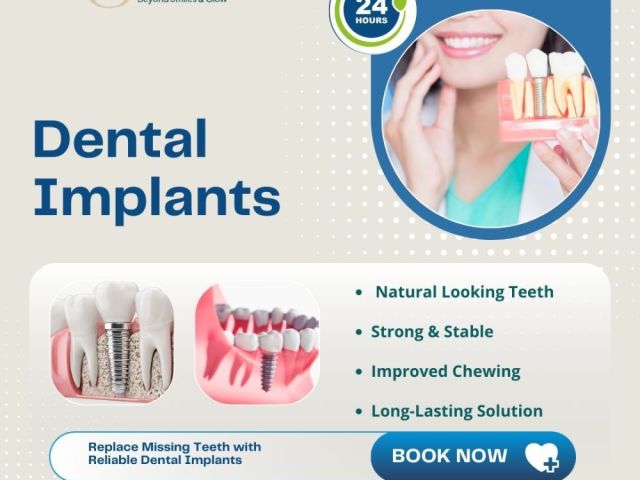 get-strong-teeth-with-dental-implants-in-ahmedabad