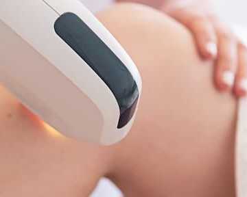 expert-laser-hair-reduction-in-delhi-for-all-skin-types