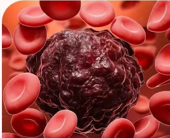 hematologist-doctor-in-hyderabad-big-0